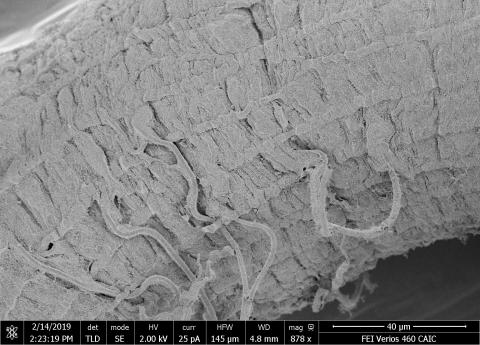 Drosophila gut muscle