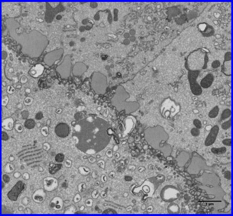 Boundary between the developing oocyte (left) and follicle cells (right).