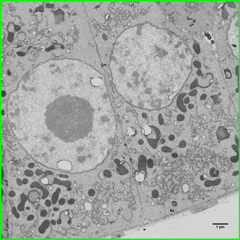 Follicle cells with large nuclei and mitochondria of various shapes.