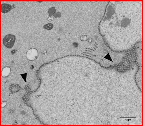 Nurse cell nucleus showing the numerous pores in the nuclear membrane.