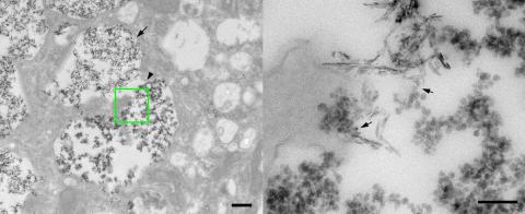 HA nanoparticles are subject to degradation inside these vesicles changing from a thin platelet-like appearance to a smooth, round morphology; scale bars are 100 nm.