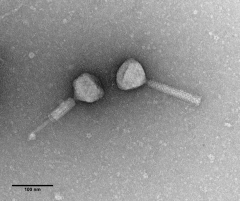 MSPA55 bacteriophages isolated from P. aeruginosa with long tails, which can be seen here in the contracted and non-contracted forms (Maria Stroyakovski, Prof. George PC Salmond group, Biochemistry, Cambridge)