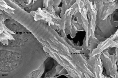 Bovine tendon collagen induced to mineralize in vitro (Karin Müller, Melinda Duer Group, Department of Chemistry, Cambridge).