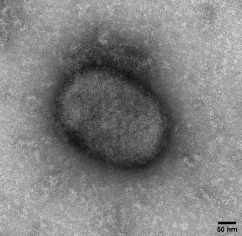 Parapox virus isolated from scrapings of lamb skin lesions (Emilie Cloup, then Queen's Veterinary School Hospital, Cambridge).