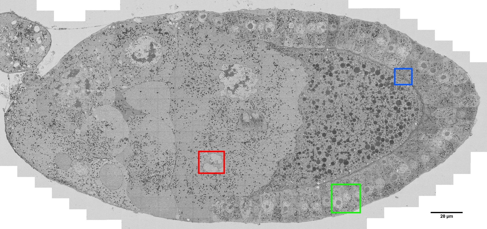 High-resolution map of a Drosophila melanogaster egg chamber: the area of the nurse cells to the left and the regular row of follicle cells to the right enclosing the developing oocyte. The areas in the coloured insets are shown in more detail below.