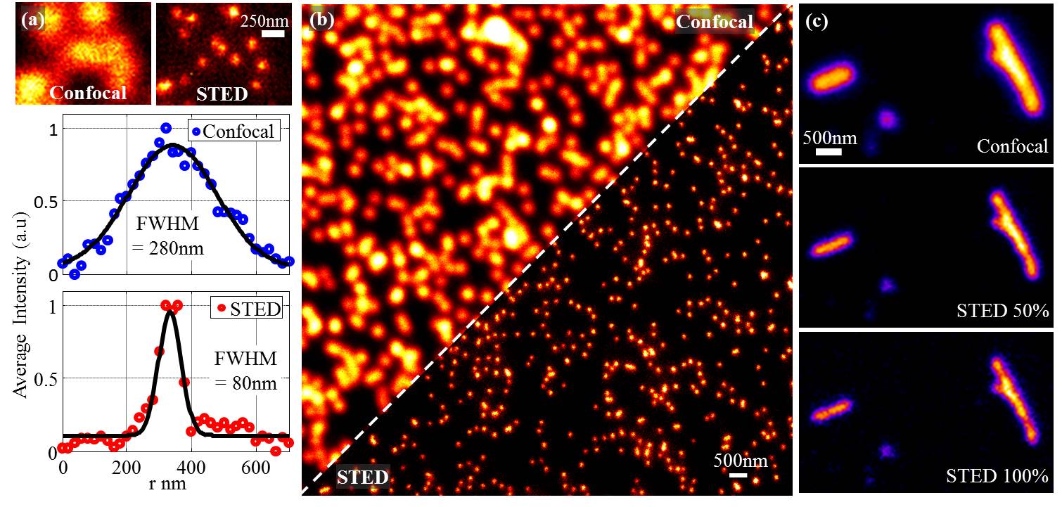 Evaluation of the performance of the lab-built STED microscope from ideal calibration samples. (a) Estimation of the resolution of the confocal/STED modality from individual antibody cluster (dye STAR 635P). The resolution enhancement is on the order of 3