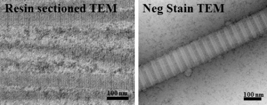 Negative stain TEM type I collagen sample compared to resin embedded collagen