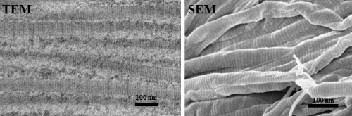 Collagen fibres as viewed under a TEM and SEM imaging systems respectively.
