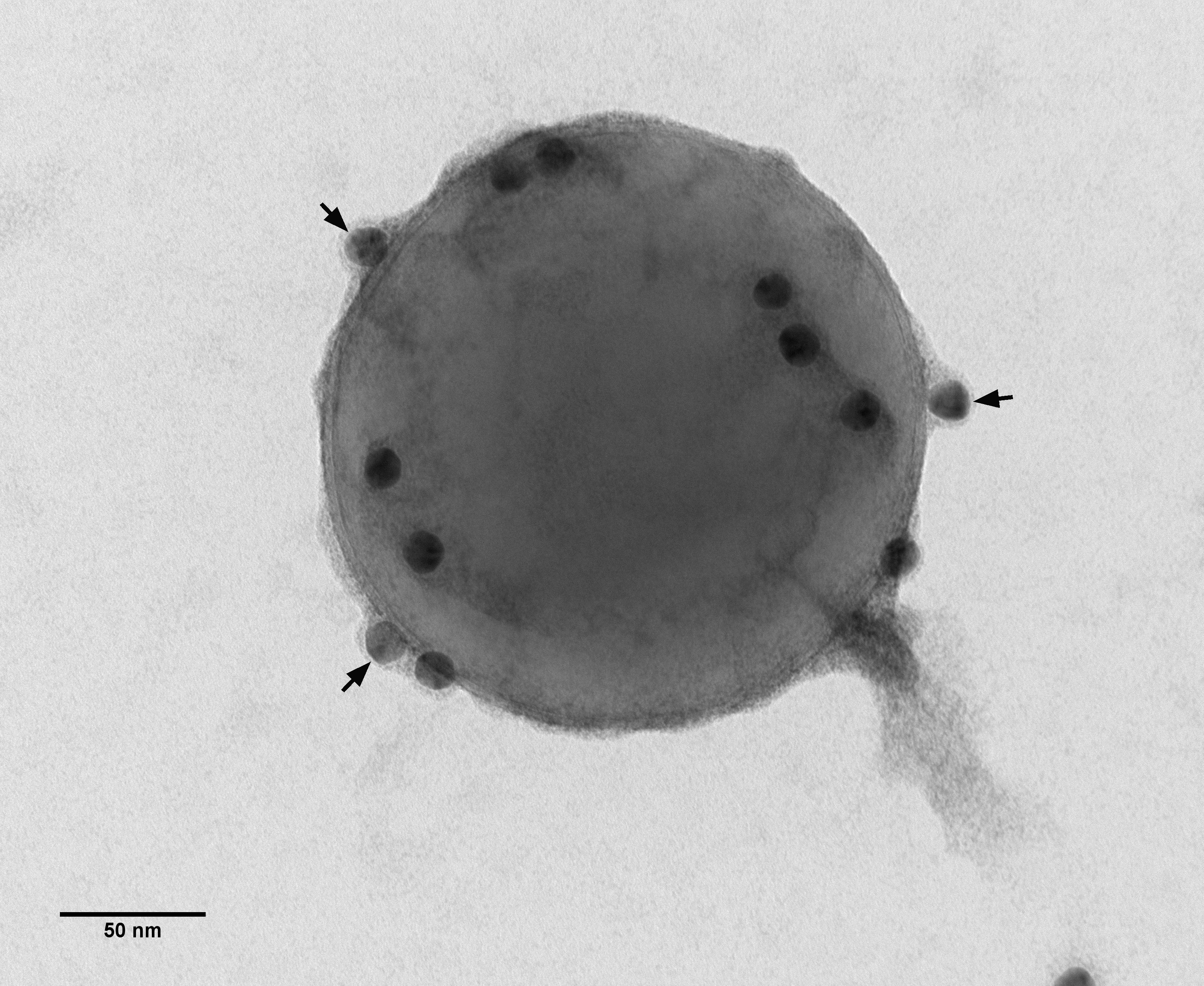 Exosomes isolated from cell culture supernatant: immuno-staining using the exosome marker anti-CD63 and a secondary antibody tagged with 15 nm gold particles (arrows), followed by uranyl acetate staining (Karin Müller, Prof. Catherine Shanahan, King’s Col