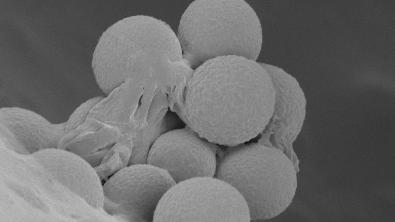 Blue cheese (fractured) showing Penicillium spores (Karin Müller, CAIC, Cambridge)