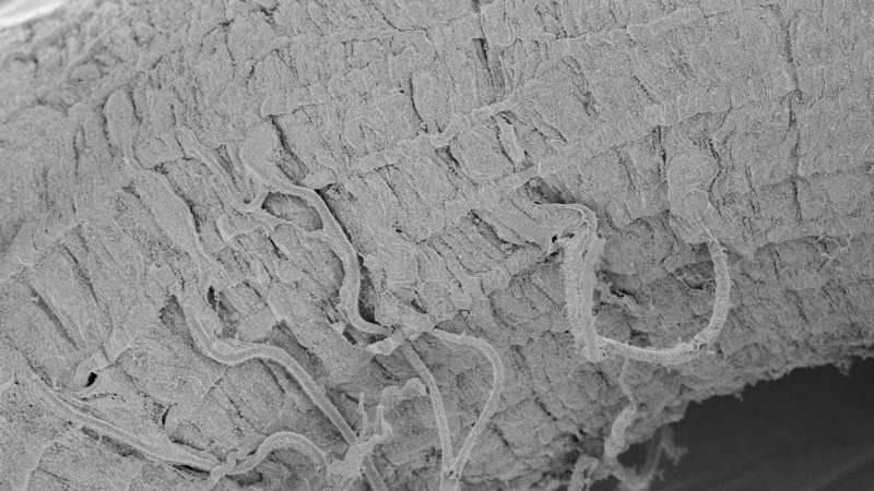 Drosophila gut muscle