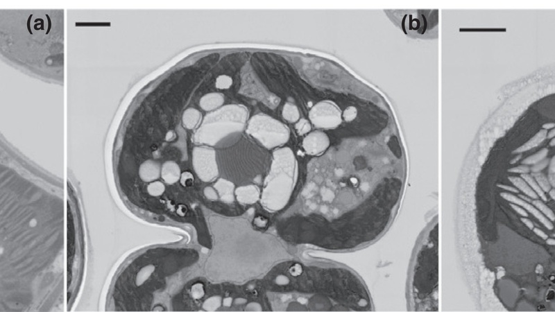SEM blockface imaging - see Fig. 3