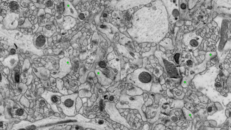 On zooming in on the high-resolution map (green inset), synapses characterized by docked pre-synaptic vesicles and post-synaptic density can be identified; six synapses are highlighted by the green dots.