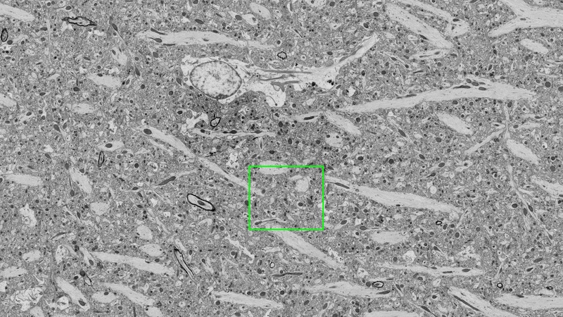 High resolution map of the synaptic region of the hippocampus defined by the green square in the overview map.