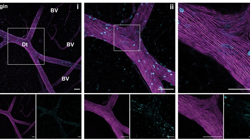 3D confocal microscopy. See figure 1 in paper for details