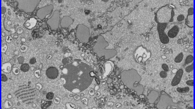 Boundary between the developing oocyte (left) and follicle cells (right).