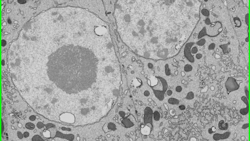 Follicle cells with large nuclei and mitochondria of various shapes.