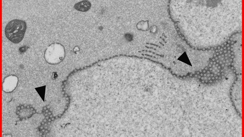Nurse cell nucleus showing the numerous pores in the nuclear membrane.