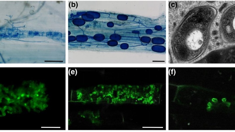 Examples of micrographs produced by a range of techniques in the study of arbuscular mycorrhizal symbiosis (brightfield, TEM and confocal microscopy).