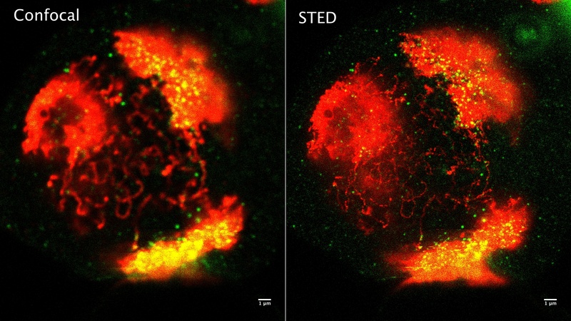 Measurement2csample5_STED_ConfMontage