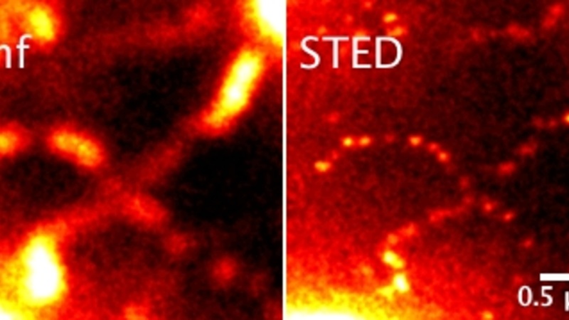 Measurement3a_combined_MontageZoom