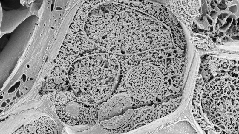 Plantain stem (fractured) showing cell walls and cell interior with various organelles and delineating membranes (Karin Müller, CAIC, Cambridge)