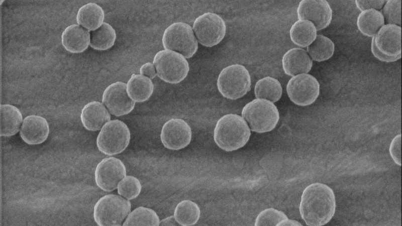 Nanoparticles with a polydopamine shell and an empty core designed for drug delivery. Melanin is a natural pigment with diverse roles in various organisms. Polydopamine NPs are a synthetic mimic of naturally occurring melanin and are studied for tissue en