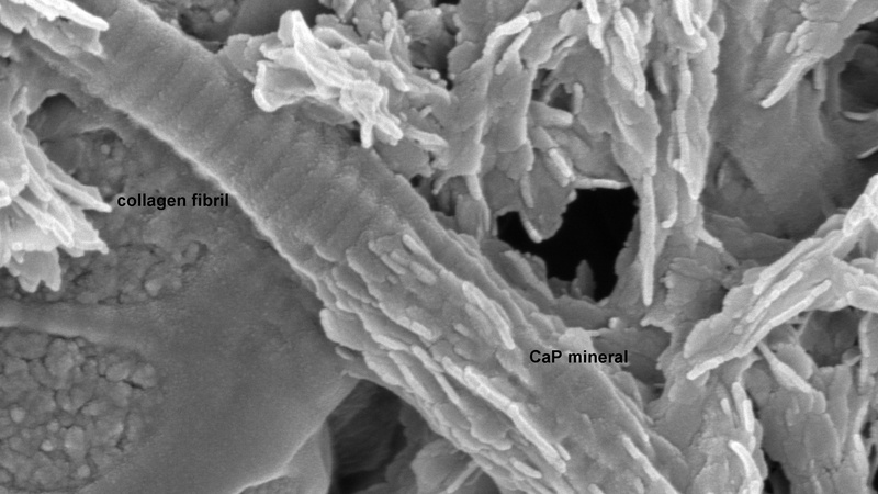 Bovine tendon collagen induced to mineralize in vitro (Karin Müller, Melinda Duer Group, Department of Chemistry, Cambridge).