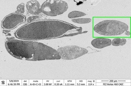 Block overview of a Drosophila ovary. A map was set up in the area delineated by the green rectangle.