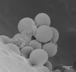 Blue cheese (fractured) showing Penicillium spores (Karin Müller, CAIC, Cambridge)