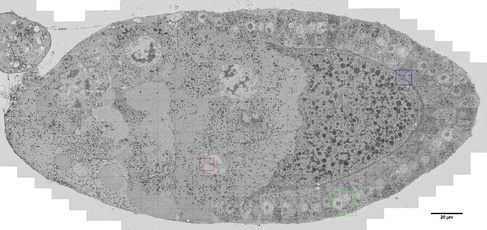  the area of the nurse cells to the left and the regular row of follicle cells to the right enclosing the developing oocyte. The areas in the coloured insets are shown in more detail below.