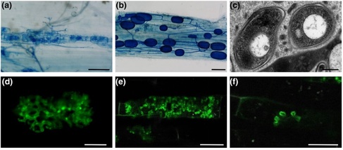 Examples of micrographs produced by a range of techniques in the study of arbuscular mycorrhizal symbiosis (brightfield, TEM and confocal microscopy).