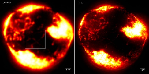 Measurement3a_combined_Montage