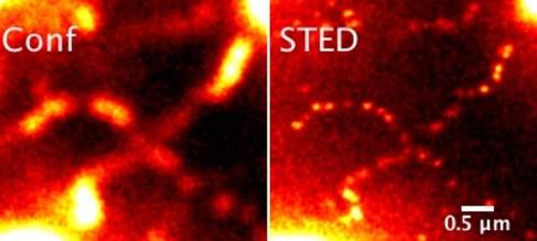 Measurement3a_combined_MontageZoom