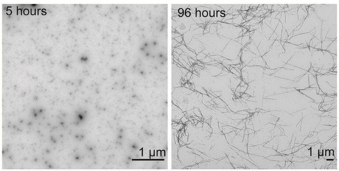TEM. See supplementary fig S6